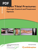 Open Tibial Fractures