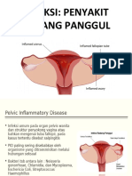 Infeksi Radang Panggul