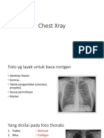 Chest Xray  Guide