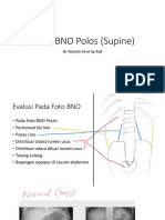 FOTO BNO Polos (Supine)