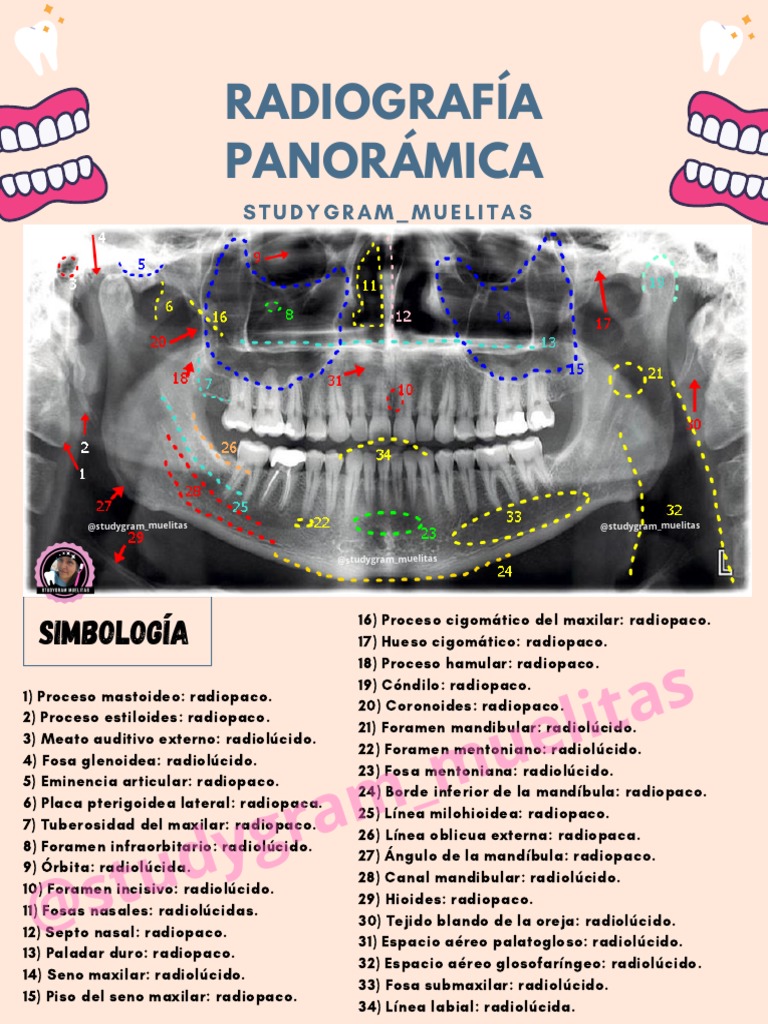 Anatomía De La Radiografía Panorámica 1340x624