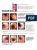 Esophageal Atlas