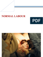 Normal Labour 400l