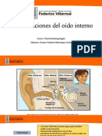 Malformaciones Del Oído Interno