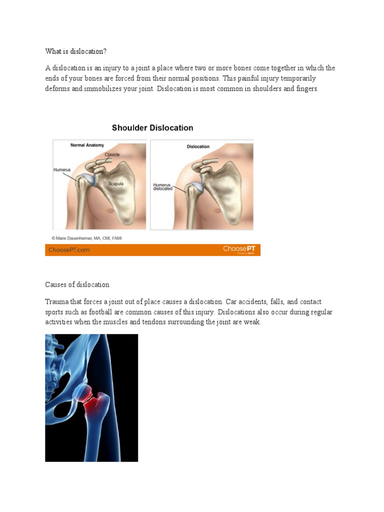 Understanding Joint Dislocation Injuries | PDF