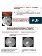 Trastornos Oculares Asociados Con Enfermedades Sistémicas