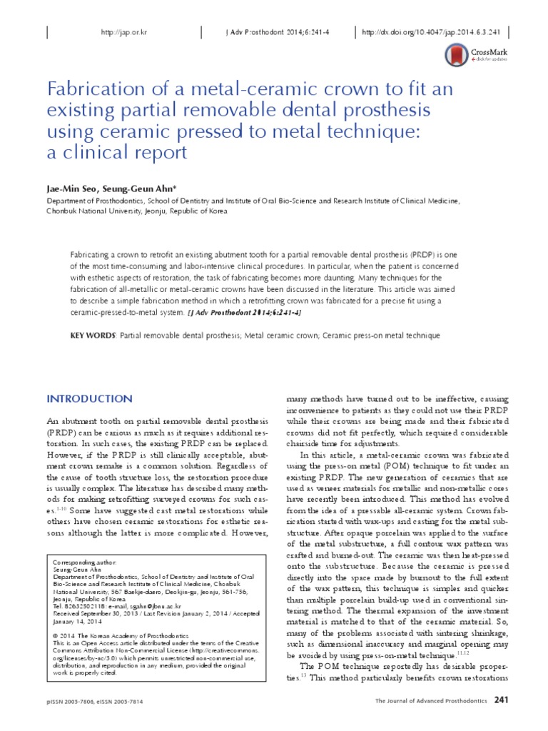 Fabrication of A MetalCeramic Crown To Fit An Existing Partial