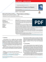 Amputation in Crush Syndrome A Case Report