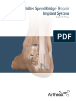 Achilles Speedbridge Repair Implant System: Surgical Technique