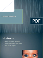 Presentation Retinoblastoma