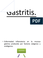 Gastritis: causas, tipos y tratamiento