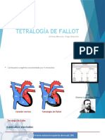 Tetralogía de Fallot: anomalías, fisiopatología y tratamiento