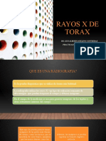Rayos X de Torax