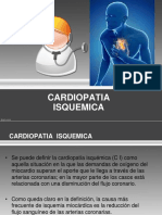 Cardiopatia isquemica