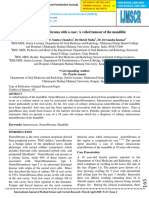 Reviewing Neurofibroma