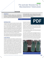 Pre-auricular abscess due to mycobacterium Tuberculosis