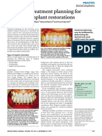 Treatment Planning For Implant Restorations: Dental Implants