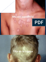 Clase 5.2 Micosis Superficial