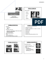 Formas clínicas da paralisia cerebral