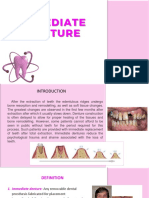 Immediate Dentures - 1