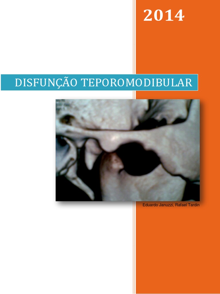 Conheça sobre o distúrbio de ATM (articulação temporomandibular) - Felipe  Porto