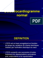 ECG normal (ED n°1)