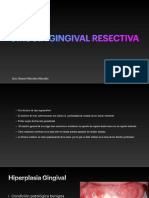 Cirugia Gingival Resectiva