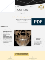 CASO CLÍNICO Tercer Molar Ectópico en Seno Maxilar