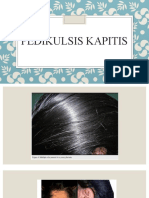 Pedikulosis Kapitis