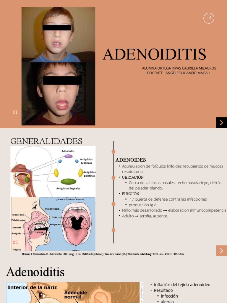 The Link between Adenoids and Nasopharyngeal Carcinoma | IntechOpen, image size:768x1024