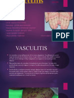 Vasculitis 2