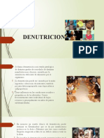 Denutricion Dietetica