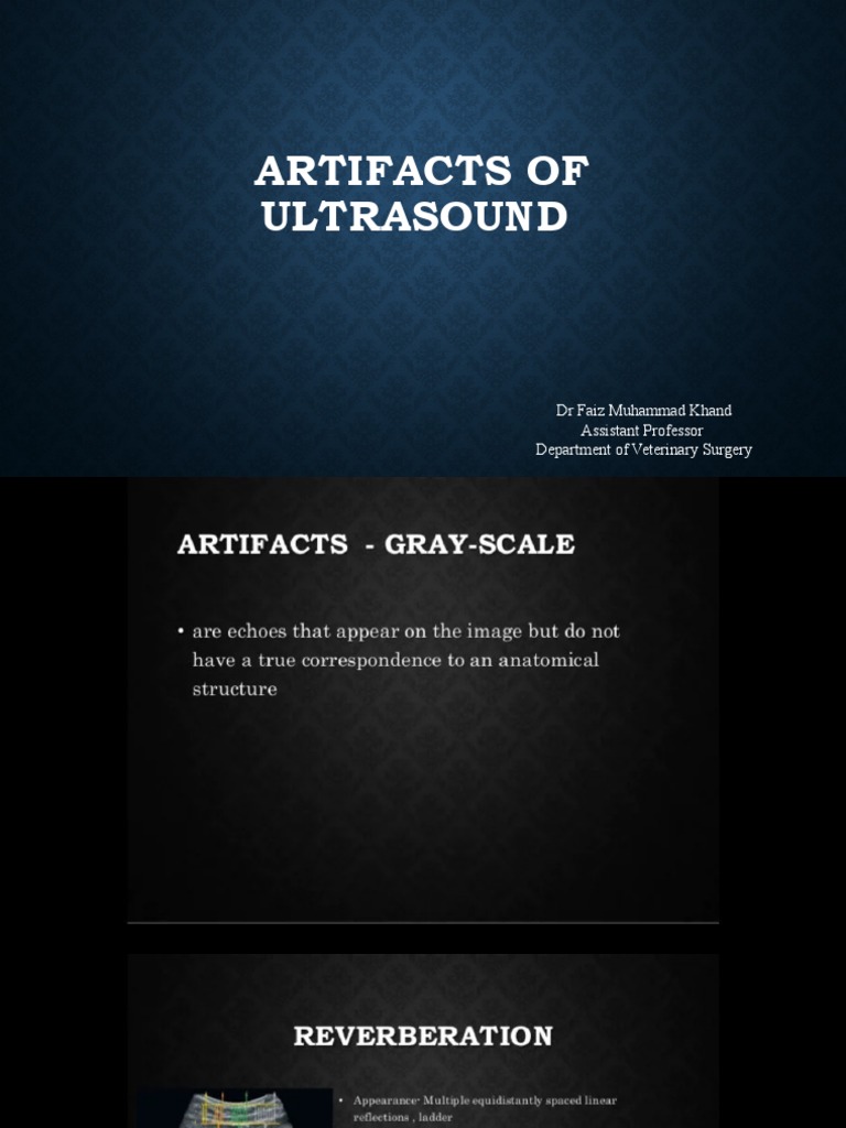 Artifacts of Ultrasound PDF