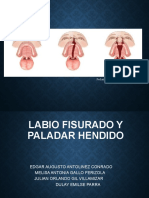 Labio Hendido y Paladar Hendido