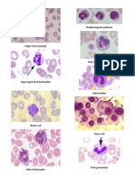 WBC Abnormalities (PPT Pictures)