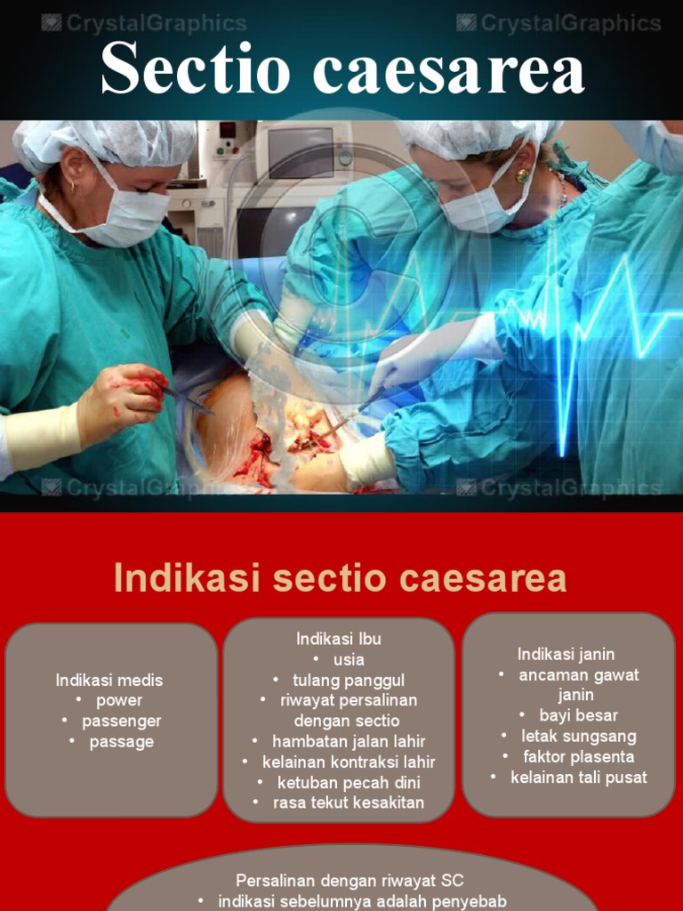 Sectio Caesarea | PDF