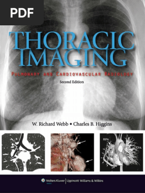 Webb - Thoracic Imaging - Pulmonary and Cardiovascular Radiology