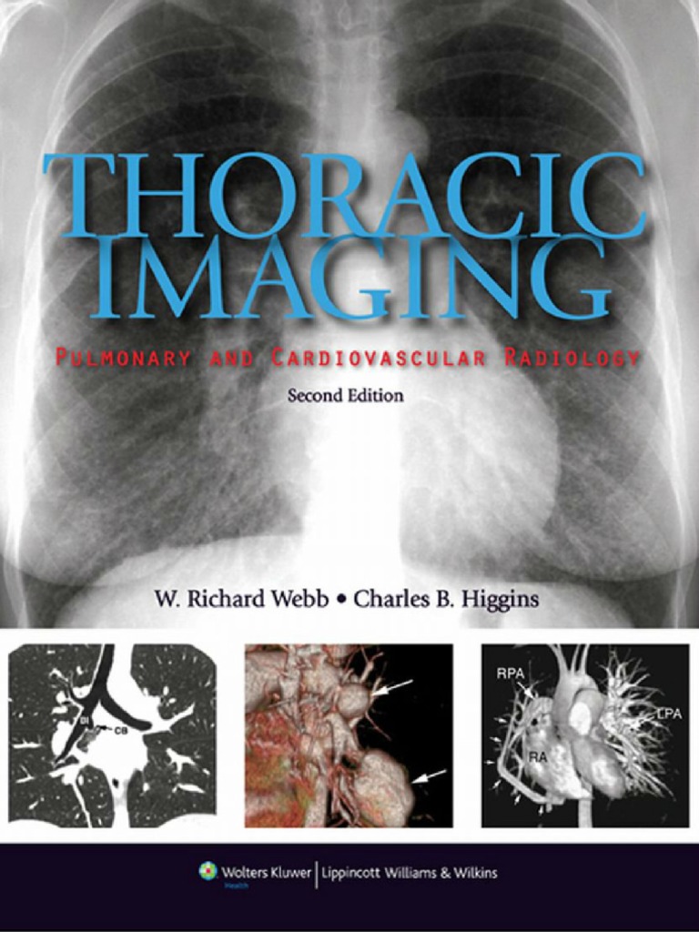 b Thoracic Imaging Pulmonary and Cardiovascular Radiology, 2nd
