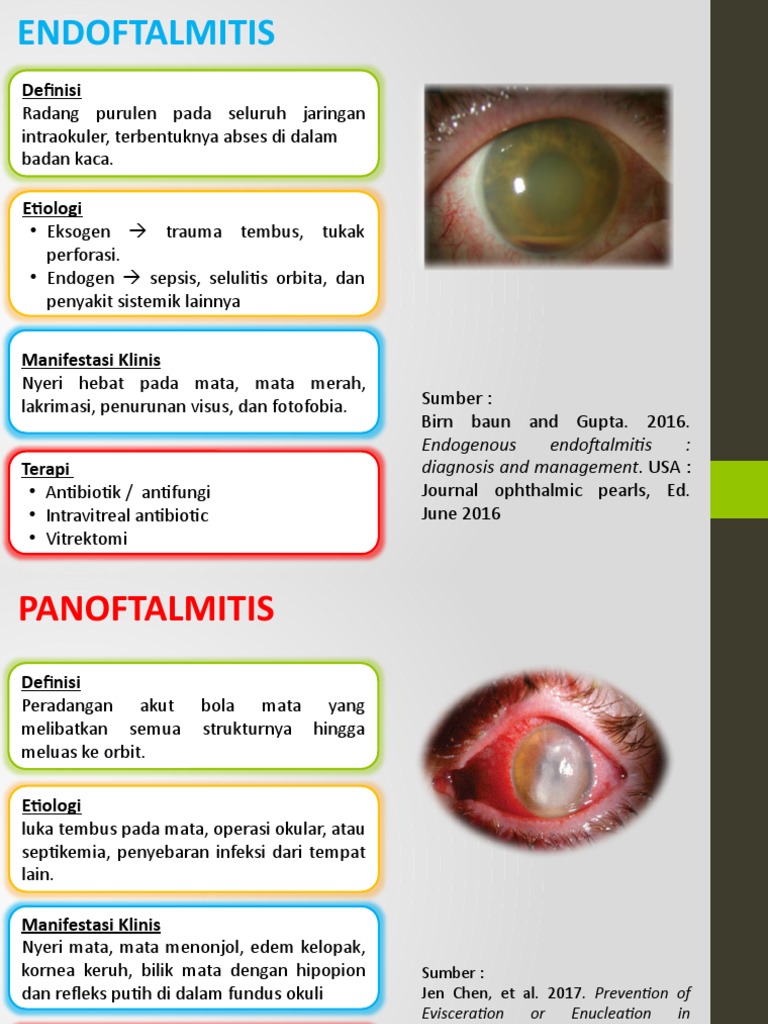 Endoftalmitis and Panoftalmitis | PDF