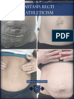 How to Manage Diastasis Recti for Athletes