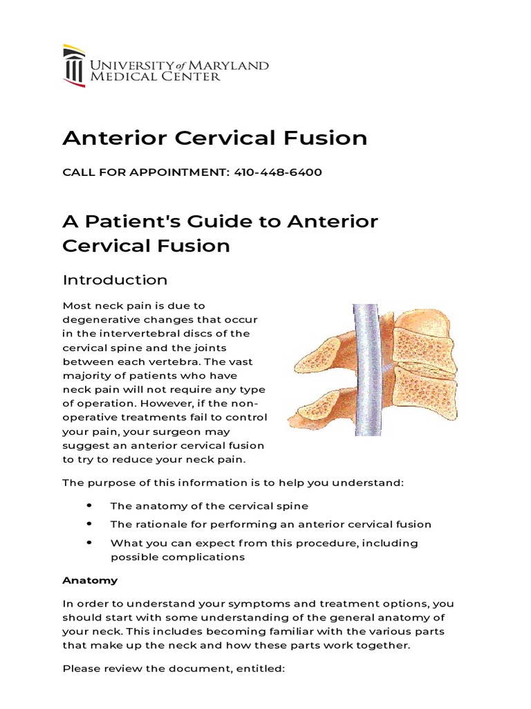 A Patient's Guide To Anterior Cervical Fusion | PDF | Vertebral Column ...