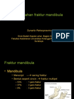 1 Surgical Treatment of Mandible Fracture