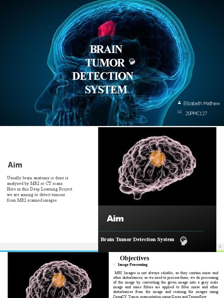 AI for Brain Tumor Detection | PDF | Deep Learning | Neuroscience