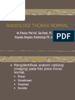 Radiologi Thorax Normal: DR - Fauzy Ma'ruf, SP - Rad, M.Kes Kepala Bagian Radiologi-FK Unizar