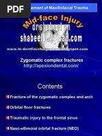Download Zygomatico Frontal Fracture by Shabeel Pn SN55803348 doc pdf