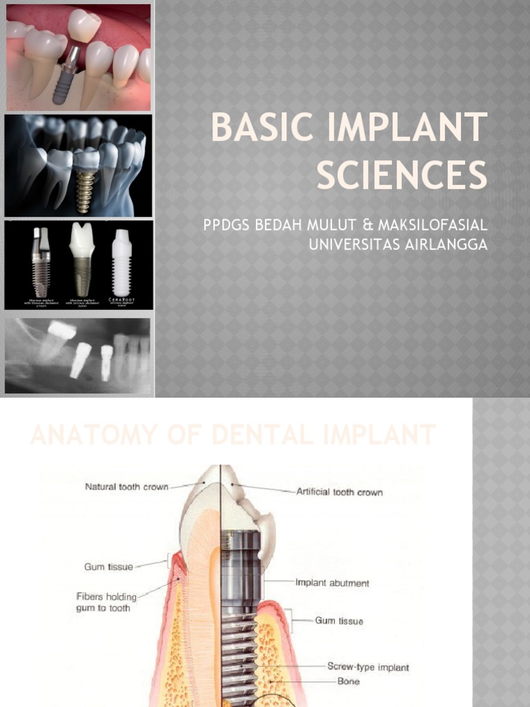 Basic Implant Sciences 20 Sabtu 29 April 2017 Pdf Biomaterial Bone