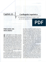 Cardiopatia Isquemica y Shock Cardiogenico