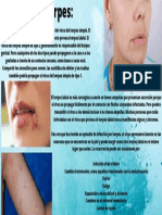 Causas Del Herpes