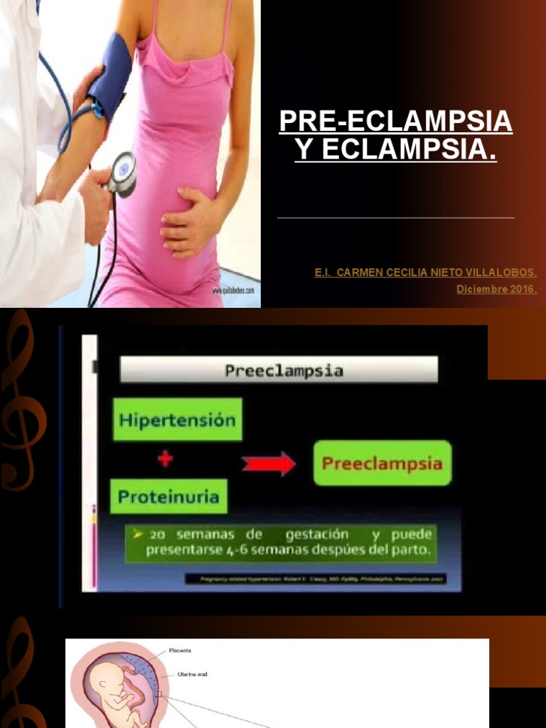 Preclamsia, Eclampsia y Sìndrome de Hellp PDF