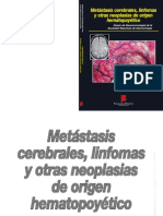 LIBRO Metastasis Cerebrales